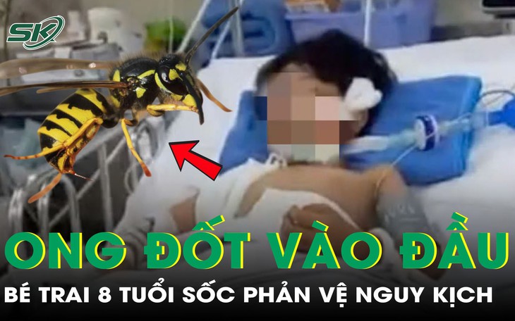 Người phụ nữ sốc phản vệ độ 3 vì bị đàn ong vò vẽ tấn công- Ảnh 2.