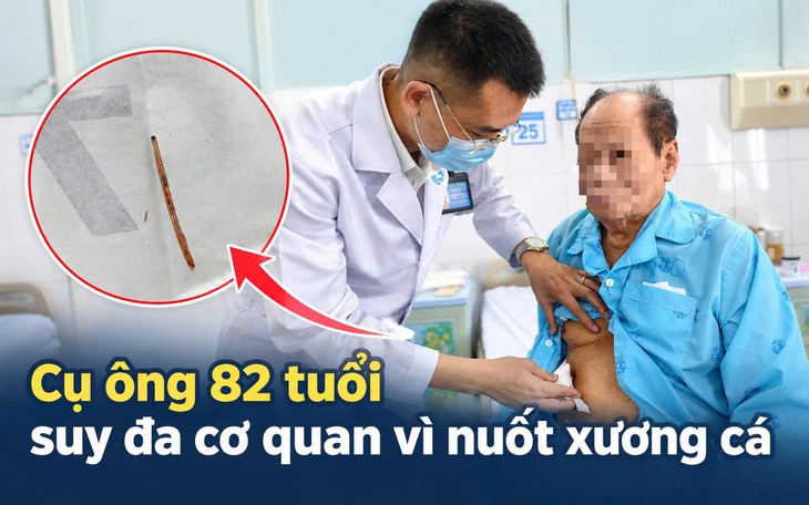 Người đàn ông phải trải qua ca phẫu thuật phức tạp vì mẩu xương cá - Ảnh 3.