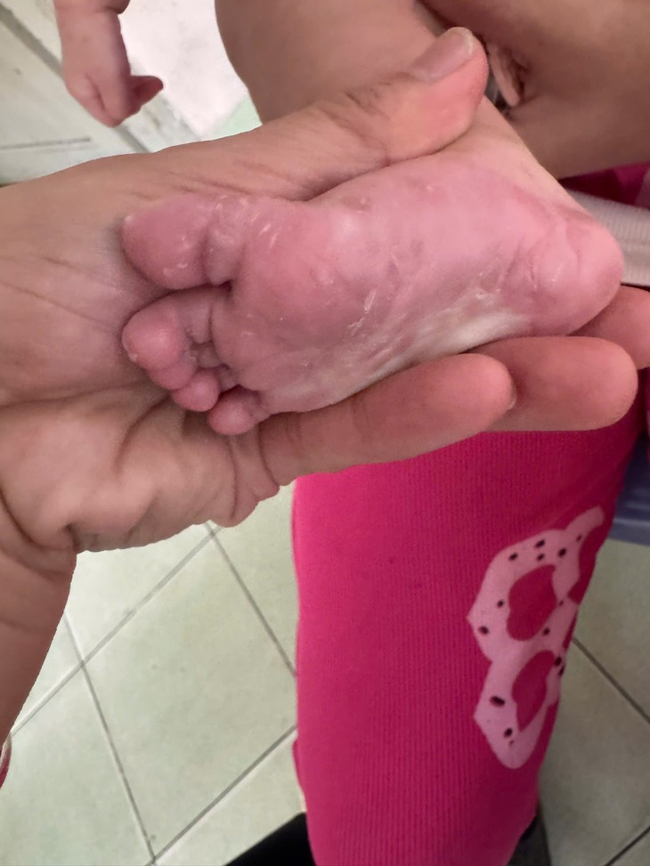 Bé gái 3 tháng tuổi mắc giang mai bẩm sinh - Ảnh 1.