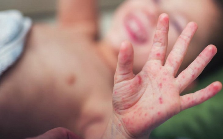 Vệ sinh nhà cửa đúng cách để giảm lây truyền bệnh truyền nhiễm- Ảnh 1.
