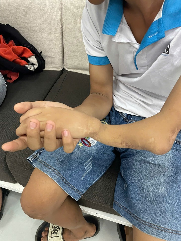 Cậu bé với 'cánh tay không xương' và hành trình hơn 10 năm đi tìm hy vọng- Ảnh 1.