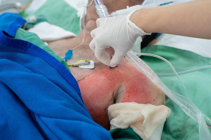 Vụ cháy nhà 7 người thương vong: 4 người bỏng hô hấp, có ca phải nhập ICU - Ảnh 1.