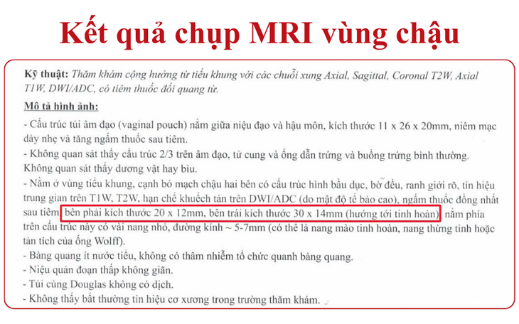 Thiếu nữ 14 tuổi mang nhiễm sắc thể nam: Ca bệnh hiếm từ dấu hiệu vô kinh - Ảnh 1.