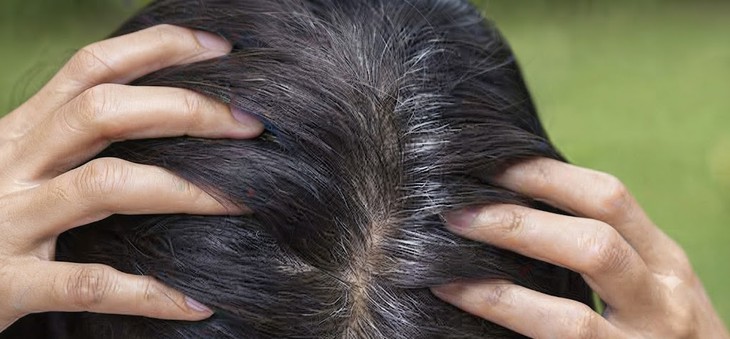Cách dùng hà thủ ô hỗ trợ ngăn ngừa tóc bạc sớm - Ảnh 1.