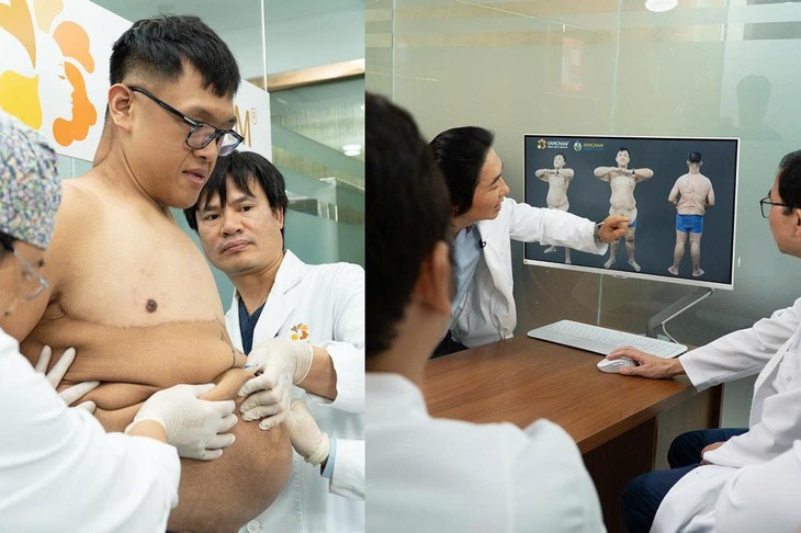 Trọng Nhân trải qua ca phẫu thuật cắt da lần thứ 3 với miếng da nặng 8.1kg- Ảnh 1.