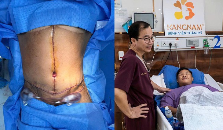 Trọng Nhân trải qua ca phẫu thuật cắt da lần thứ 3 với miếng da nặng 8.1kg- Ảnh 3.