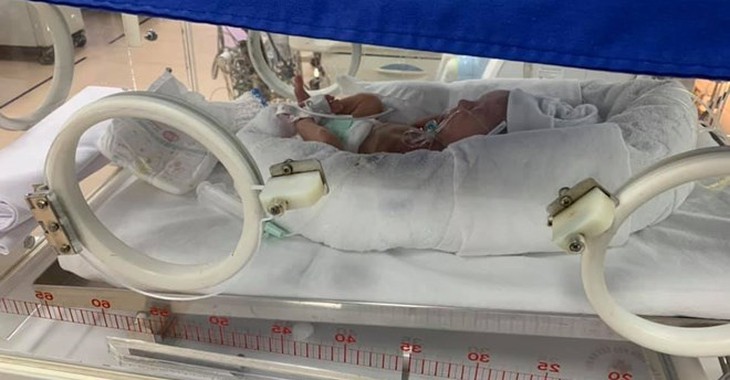 Các yếu tố nguy cơ dẫn đến sinh non mẹ bầu cần lưu ý - Ảnh 1.