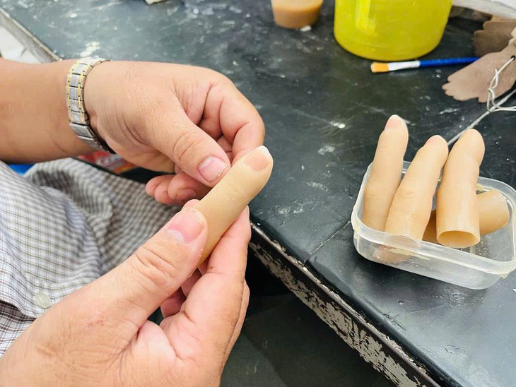 Người đàn ông ngồi xe lăn chế tác những ngón tay giả cho bệnh nhân- Ảnh 2.