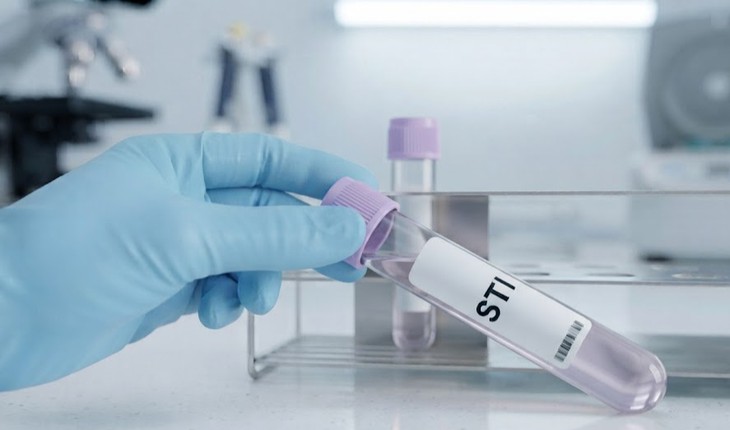 Xét nghiệm STI là gì và khi nào nên xét nghiệm? - Ảnh 1.