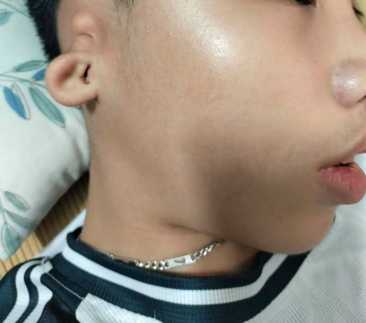 - Ảnh 1.