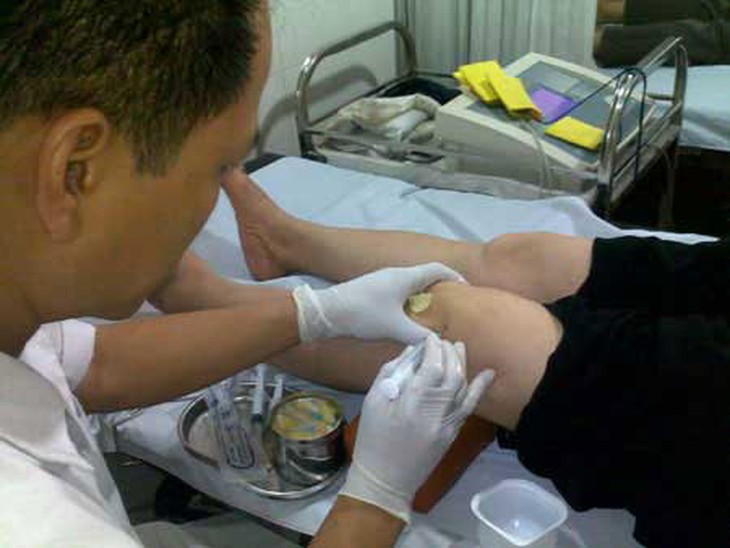Các cách điều trị đau mạn tính 1