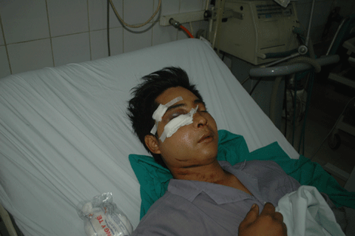Công an kết luận vụ tổ công tác 141 bị tố đánh dân 1