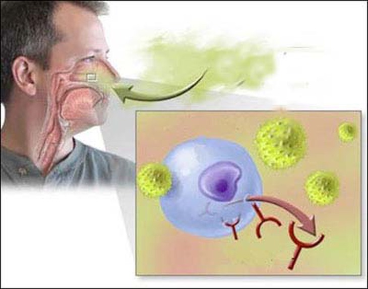Viêm mũi dị ứng và tiết xuân 1