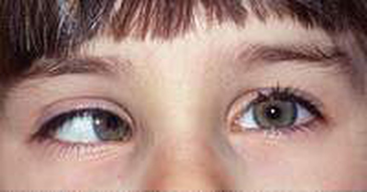 Những điều ít biết về botox 2
