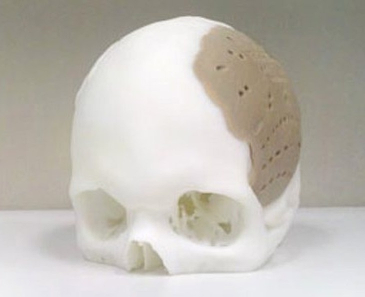 “In” đồ vật bằng công nghệ 3D 3