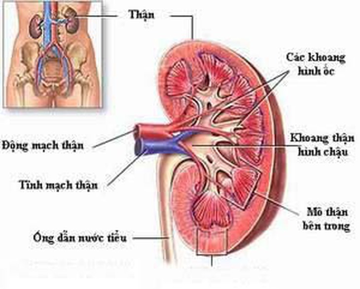 Phát hiện sớm thận đa nang để tránh suy thận  1