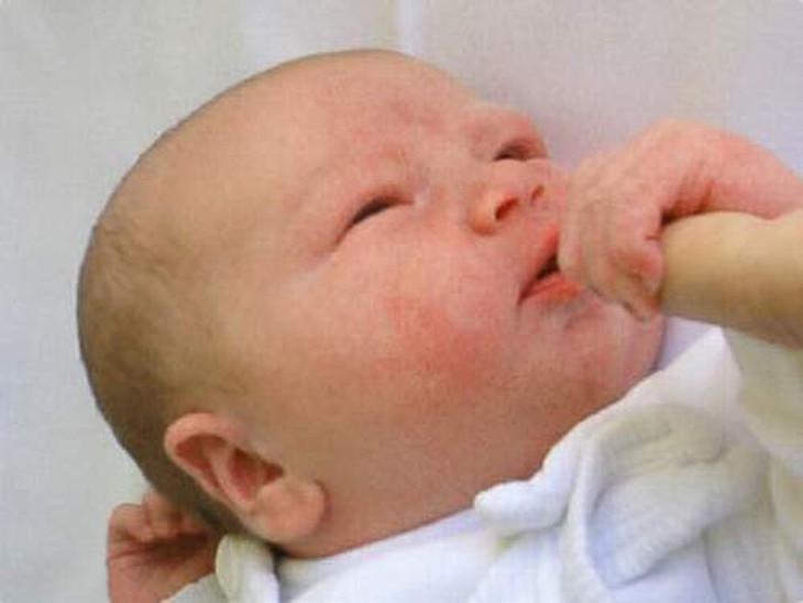 Trị mụn nhọt, mẩn ngứa từ cây có tên "đơn" 2