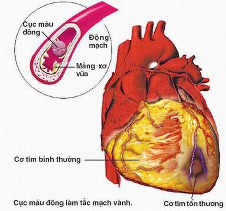 Dinh dưỡng phòng bệnh tim mạch 1