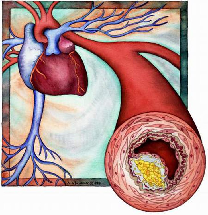 Những lưu ý khi dùng nhóm thuốc giảm mỡ máu statin 1