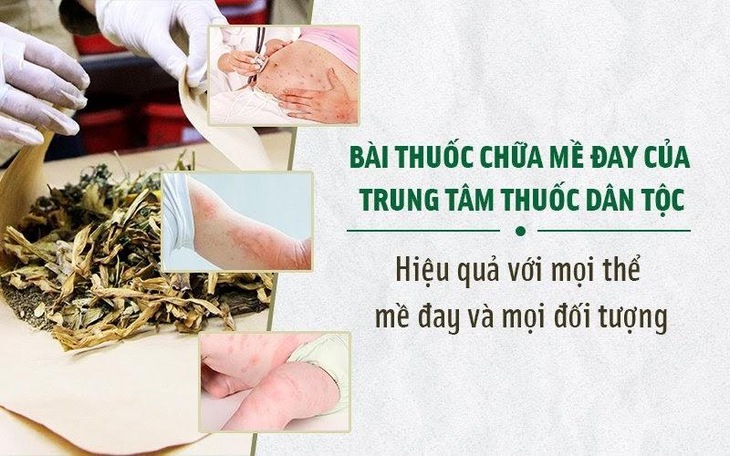 https://lh3.googleusercontent.com/Rmo5Imo4X5QzT9TaT0QhQ5pY78hDKd9hDGjrIkcAIRApSbp_t6RtA12r2lpGRaPrF6qPLZSEO3F-HzI6odKufpWjnab07ppHwDdSVEAsdT585lPAnYrn2LXTgFJ68pYOrmc9_59M