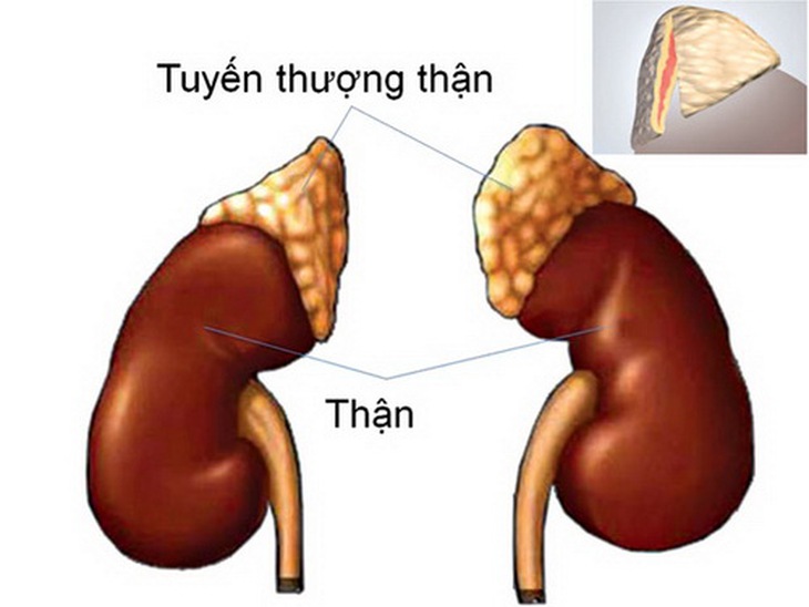 Tăng sản thượng thận bẩm sinh gây dậy thì sớm ở trẻ trai.