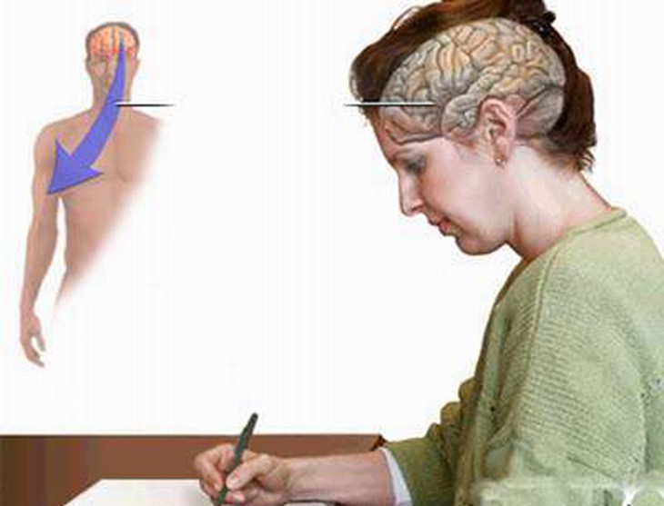 Rối loạn ngôn ngữ do tổn thương não: Phục hồi thế nào?