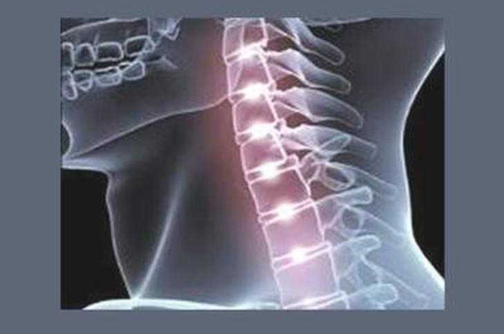 Đột biến lạnh có thể gây chứng vẹo cổ