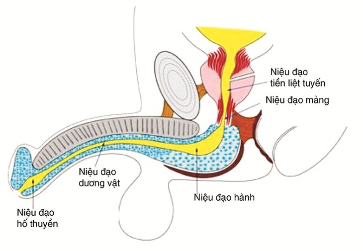 Hẹp niệu đạo
