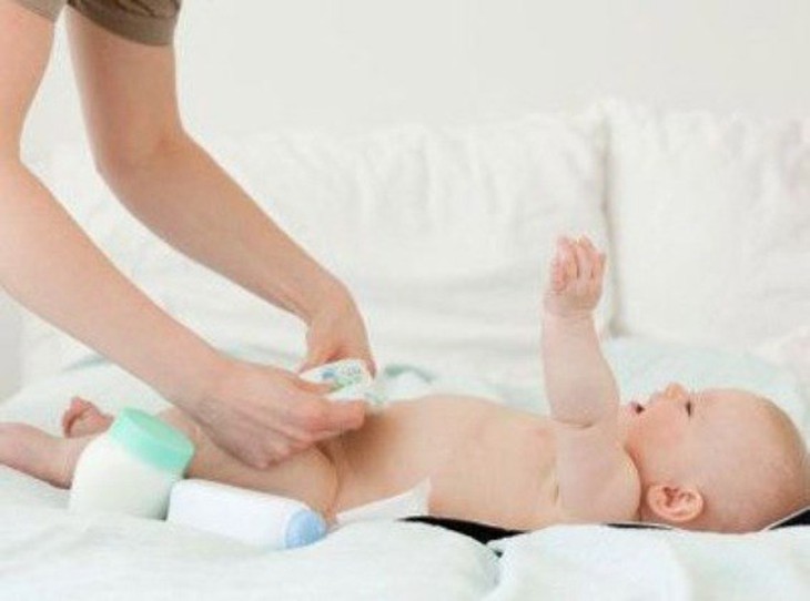 Cách nào để bé không bị lồi rốn?