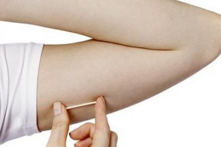 Những điều cần biết về que cấy tránh thai