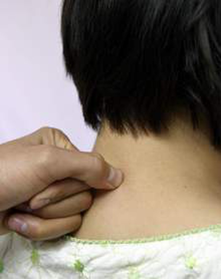 Đông y chữa viêm xoang mũi, tắc mũi