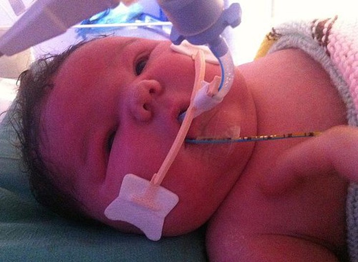 Bé sơ sinh khổng lồ gần 6kg