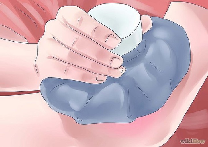 Mẹo trị mề đay- đắp gạc lạnh