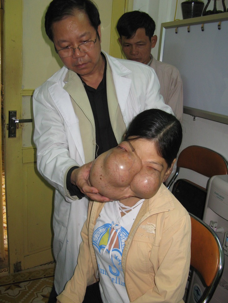 BS. Nguyễn Quốc Bảo khám cho gia đình bệnh nhân có u quái 2