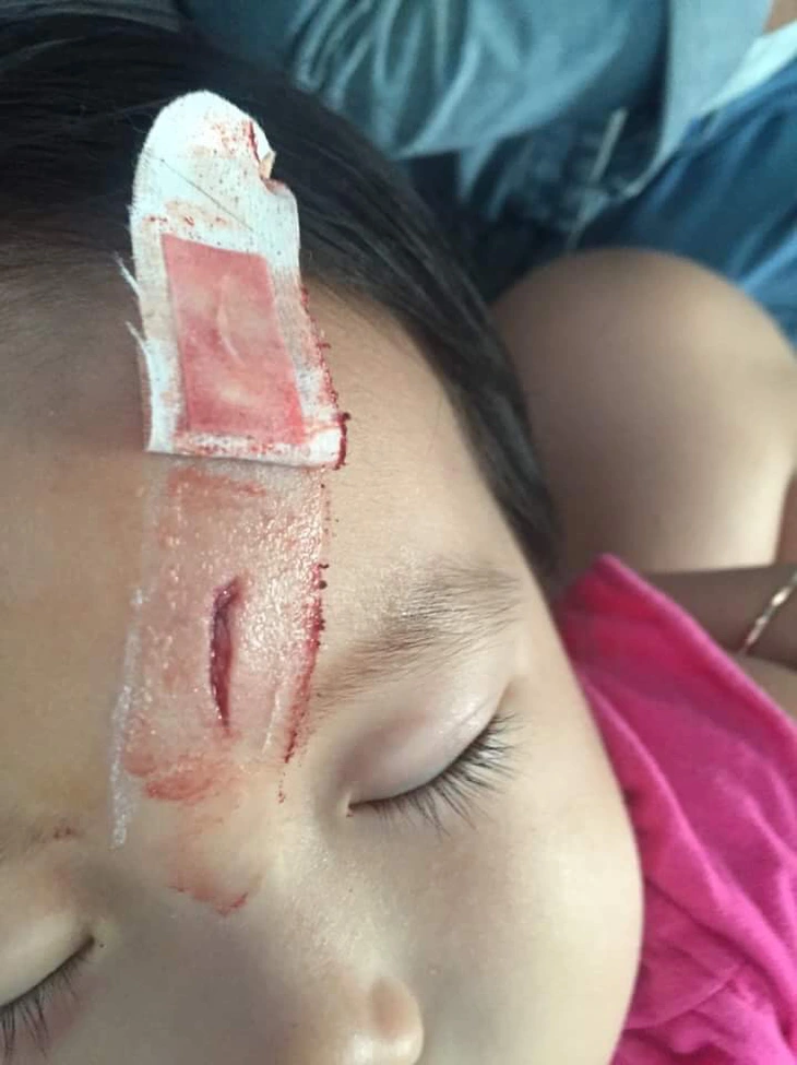 bị gà mổ, vết thương sâu nên tiêm phòng uốn ván