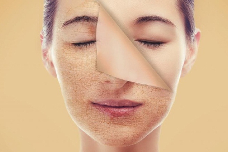 Thói quen hằng ngày bất lợi cho da