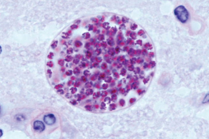 Tụ cầu vàng kháng methicillin - MRSA