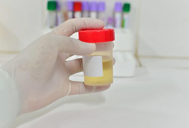 Dấu hiệu mắc bệnh về bàng quang