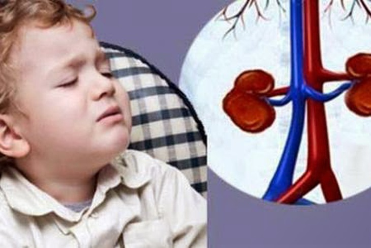 Những điều cần biết về hội chứng thận hư ở trẻ em