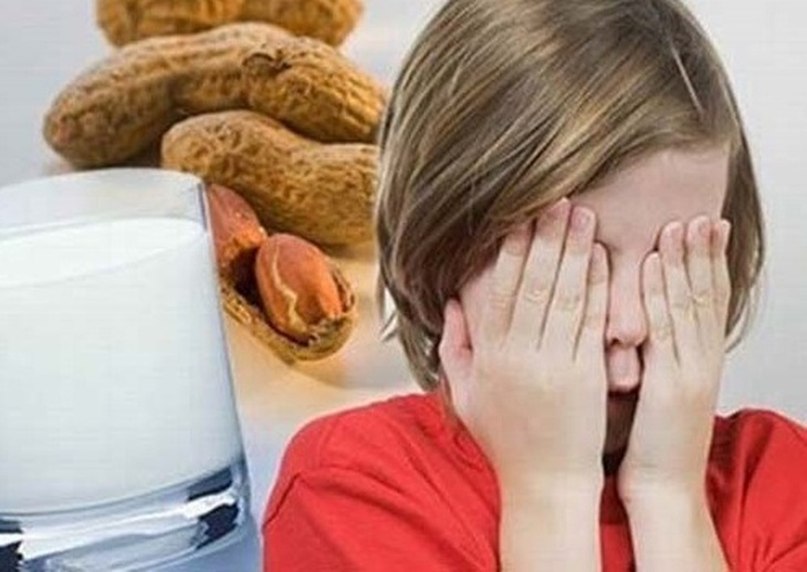 Một số tác nhân gây dị ứng.