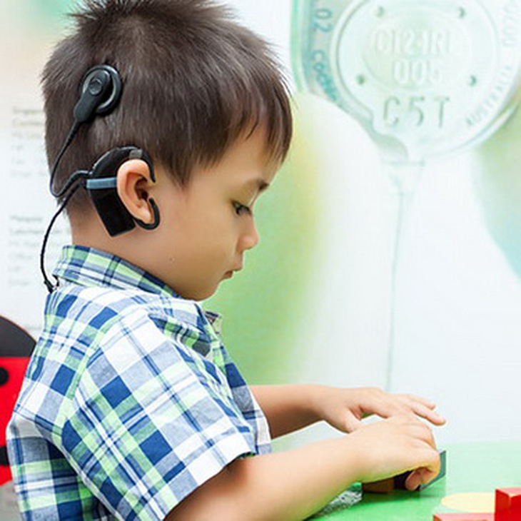 Cấy ghép ốc tai điện tử giúp kích thích dây thần kinh thính giác.