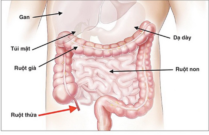 Thủng đường tiêu hóa rất nghiêm trọng và cần được cấp cứu ngoại khoa kịp thời.