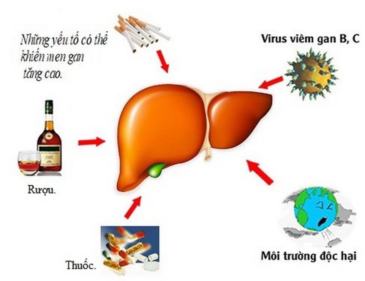 Uống nhiều rượu, mắc viêm gan B, C, hút thuốc, môi trường độc hại, sử dụng quá nhiều thuốc… là những nguyên nhân gây tăng men gan.