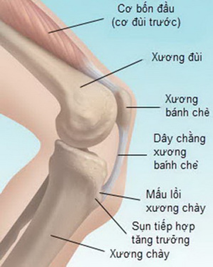 Bệnh Osgood – Schlatter gây đau đầu gối, phía trước xương chày.