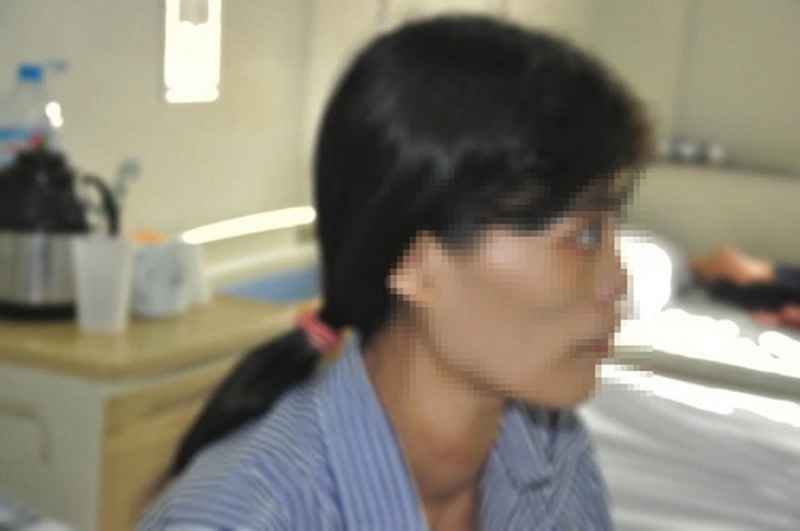 Bệnh nhân Th. tự ý điều trị thuốc Nam chữa bệnh Basedow.