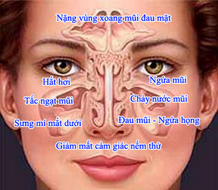 Các bệnh về mũi xoang gây hắt hơi.