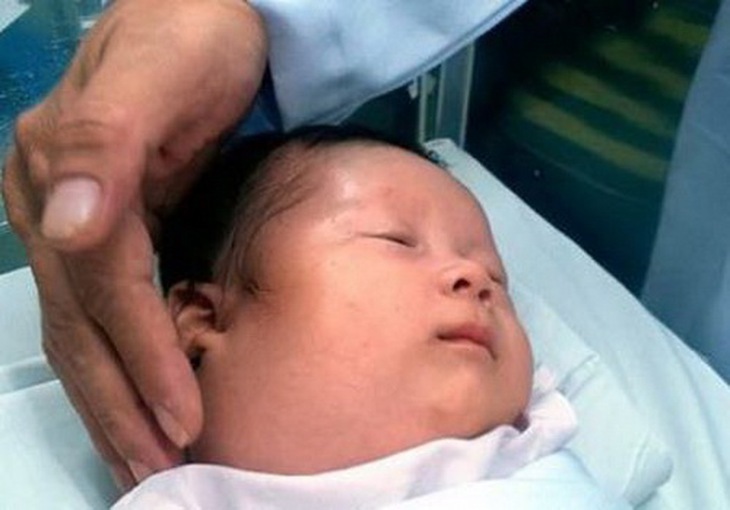 Thanh đại (bột chàm) và ít băng phiến chế với nước ấm, bôi vào chỗ đau. Trị viêm tuyến mang tai cấp tính trẻ em (quai bị).