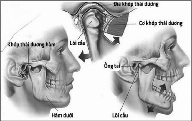 Cấu tạo khớp thái dương hàm.