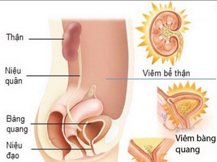 Trà râu ngô tốt cho người viêm thận, viêm đường tiết niệu...