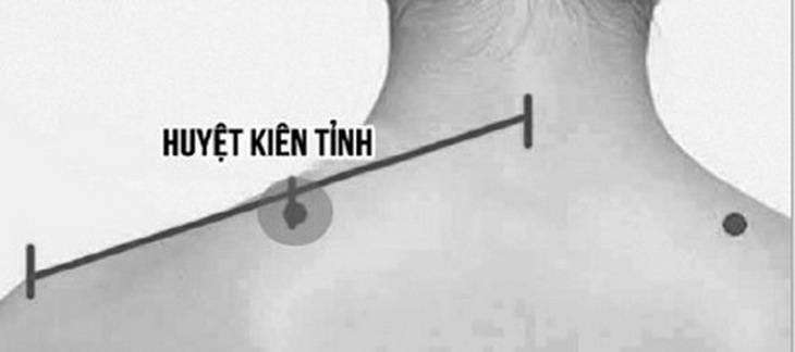 Day huyệt kiên tỉnh là một cách chữa tắc tia sữa.